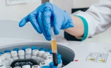 Separationstechnik in der Biochemie
