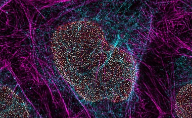 Erweiterte Bildgebung von lebenden Zellen mit nanoskaliger Auflösung