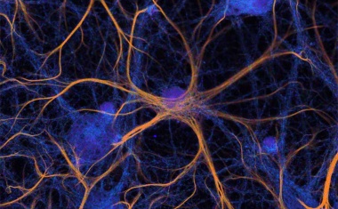 Fluorescence microscopy with ease-of-use