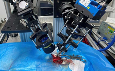 Real-time imaging of blood flow