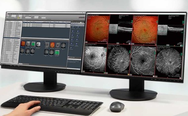EssilorLuxottica acquires majority stake in Heidelberg Engineering