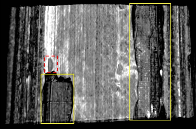 Abb 2: d) das 3D rekonstruierte Bild auf Basis der Radarmessung, deutlich...