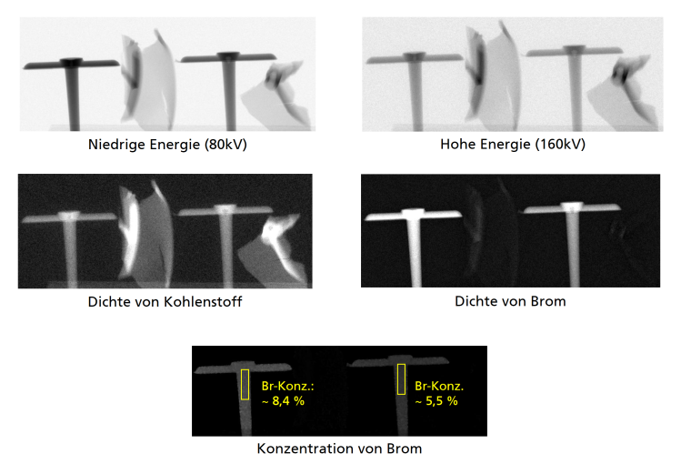 Abbildung 1: Zeigt die Vorteile von Mehrenergieröntgensystemen im Vergleich zu...