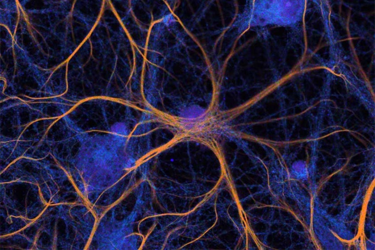 Confocal fluorescence lifetime image of fixed and stained neurons. Three labels...