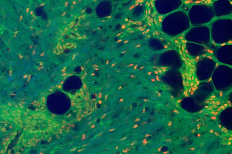 Magnification: green is a fluorescent protein stain, red is a DNA stain, and...