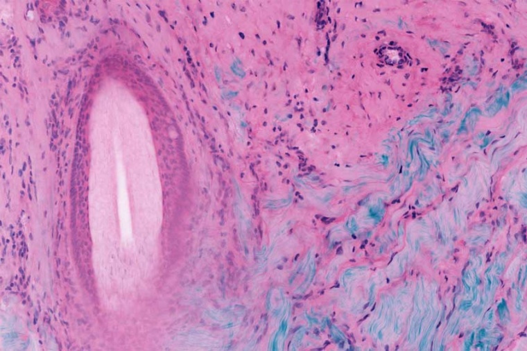 Magnification of a false-color Masson’s trichrome image of a cm-scale tissue...