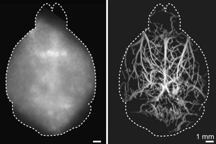 A new imaging method can capture images of vasculature deep in the brains of...