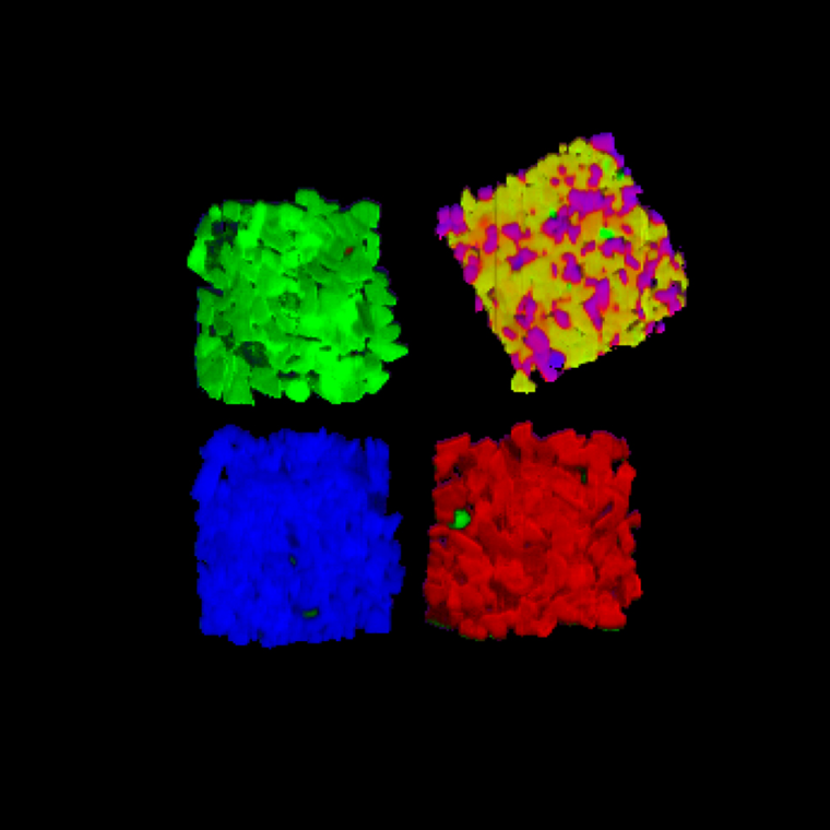 In the image the different plastics can be easily distinguished by their color...