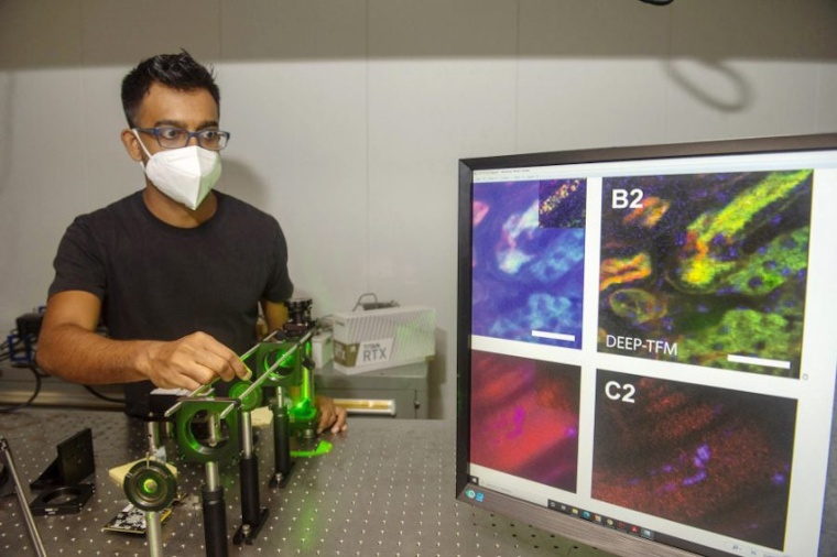 Dushan Wadduwage works with a laser in his Northwest lab where he does research...