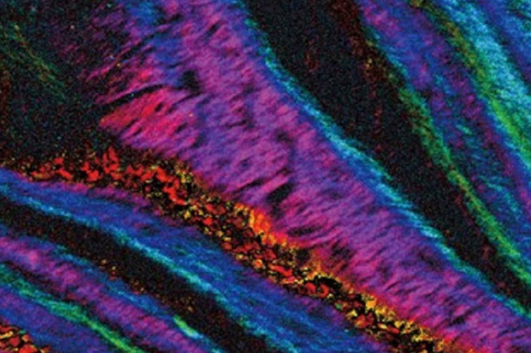 Vectorial metric image of a biomedical sample. (Source: C. He, U. Oxford /...