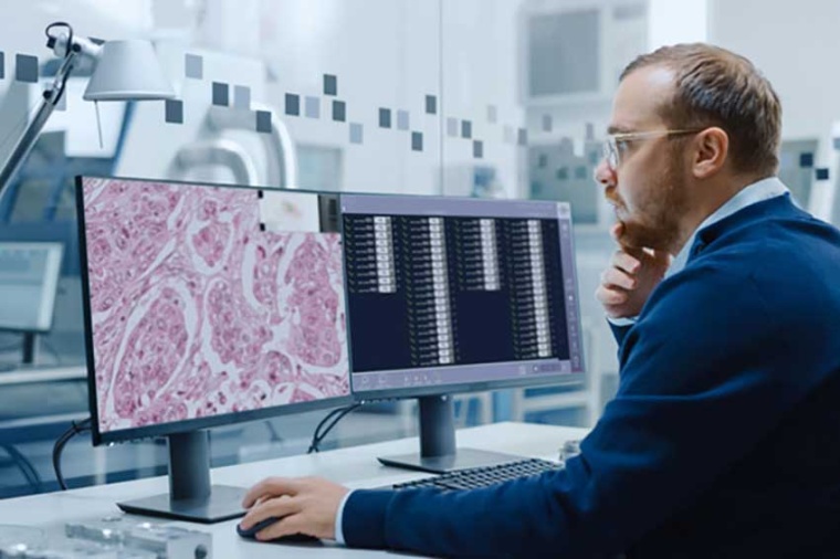 NanoZoomer scanners provide scalable solutions with each workflows to gain such...